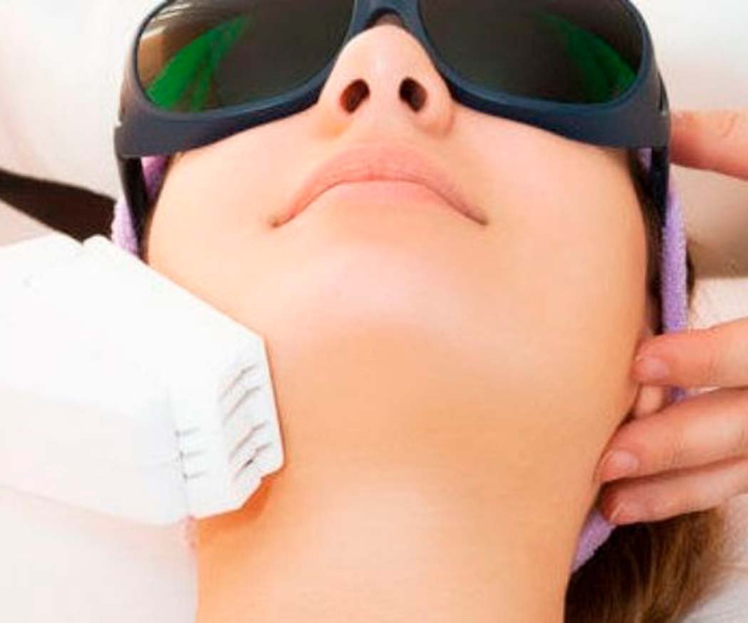 Qué es la radiofrecuencia