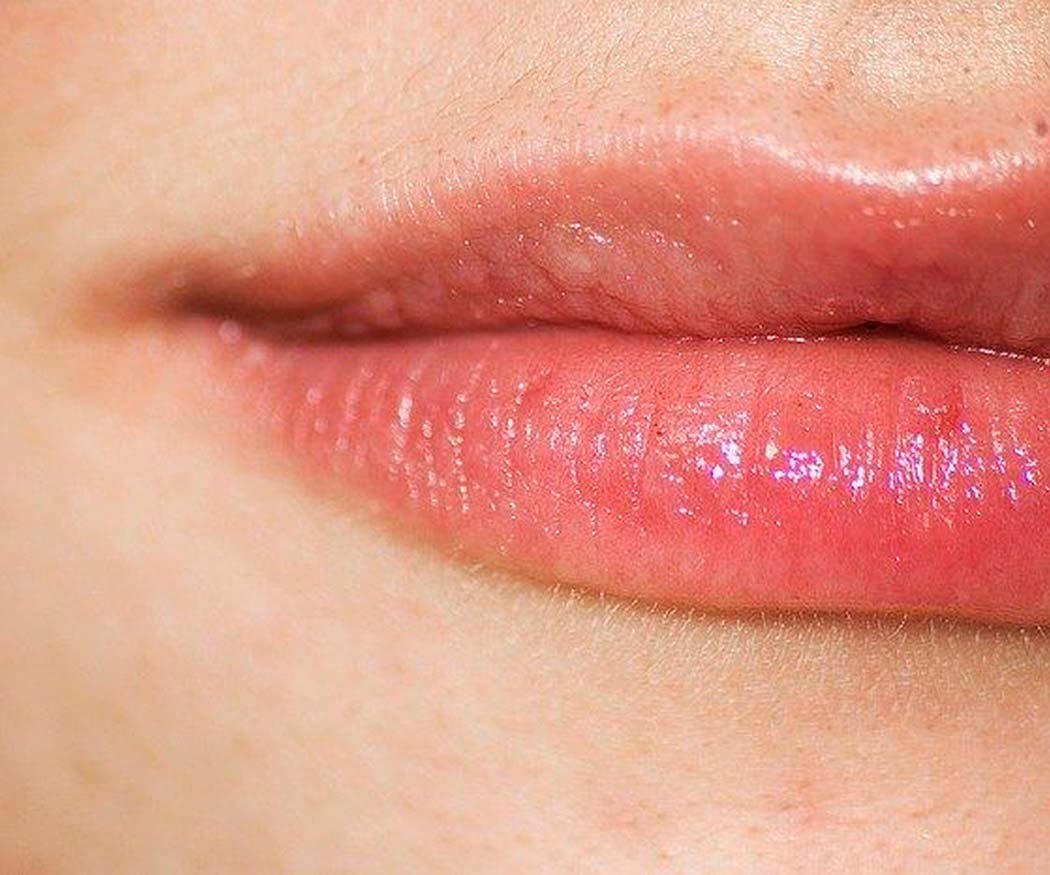 Todo lo que debes saber sobre el aumento de labios