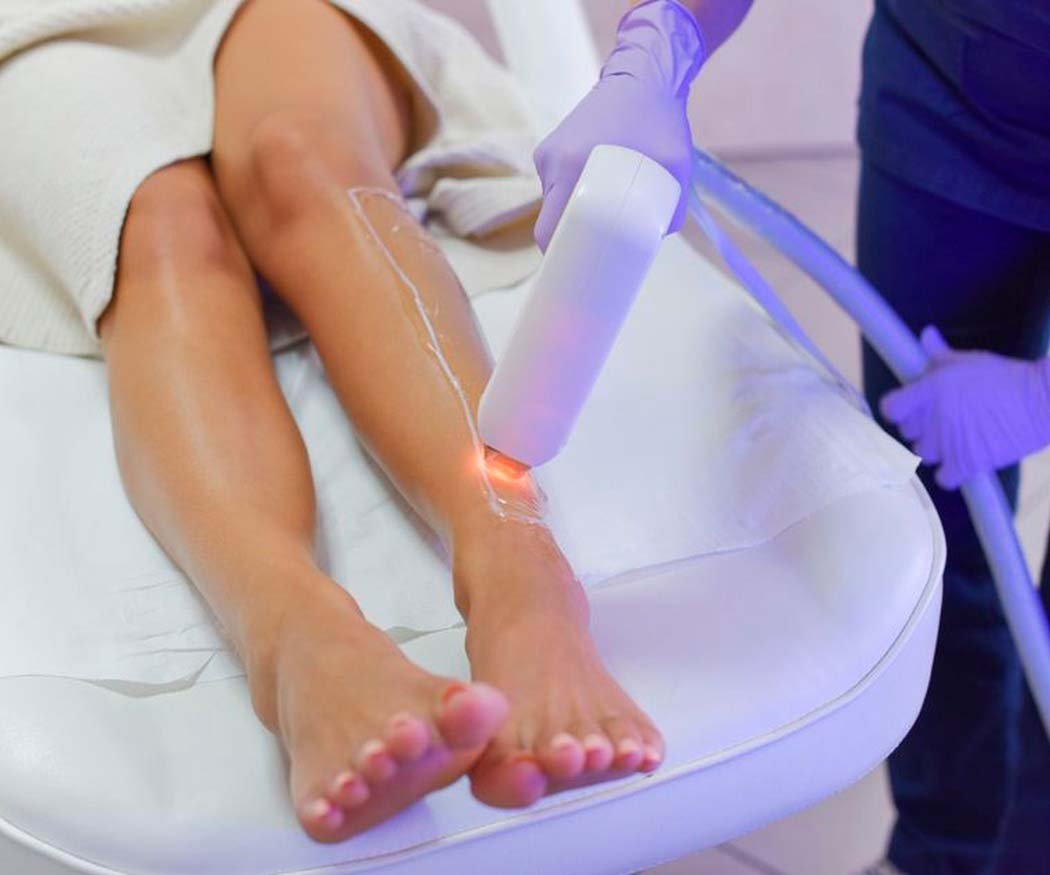 Las mejores zonas del cuerpo para realizar depilación láser