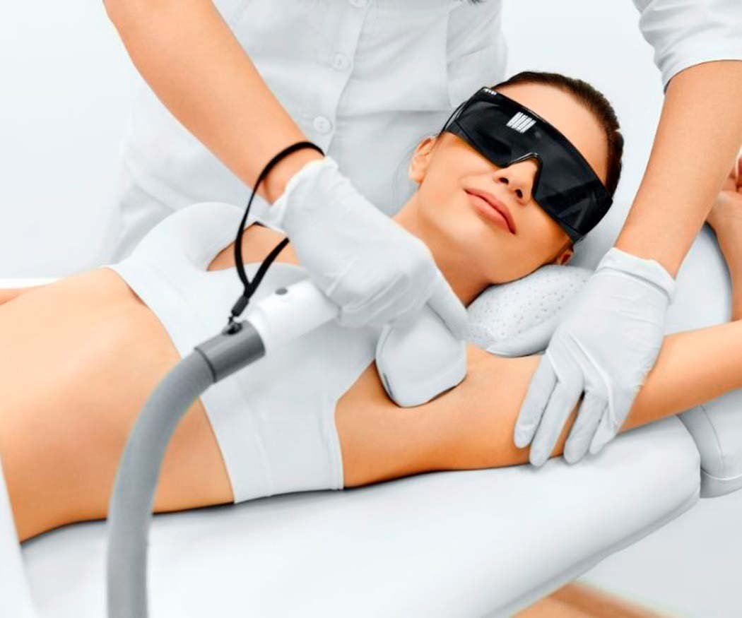 Número de sesiones láser necesarias